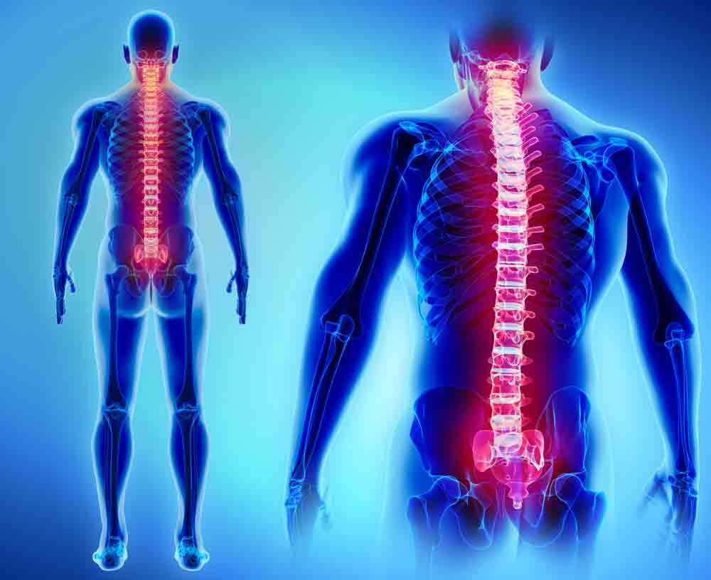 Are you suffering with back pain? spine back pain oakland physical therapy SOL 718049254 1 spinal cord injury rehabilitation, spinal cord injury rehabilitation near me, rehabilitation goals for spinal cord injury