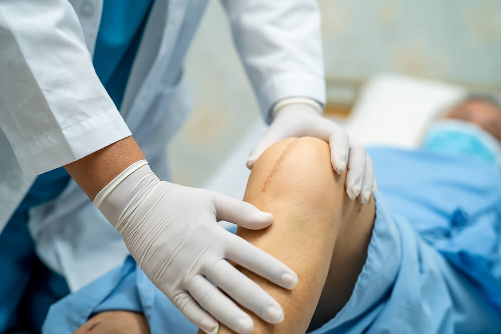 How long after a knee replacement should you wait to start PT? asian senior woman patient show her scars surgical 2023 11 27 05 29 14 utc How long after a knee replacement should you wait to start PT?
